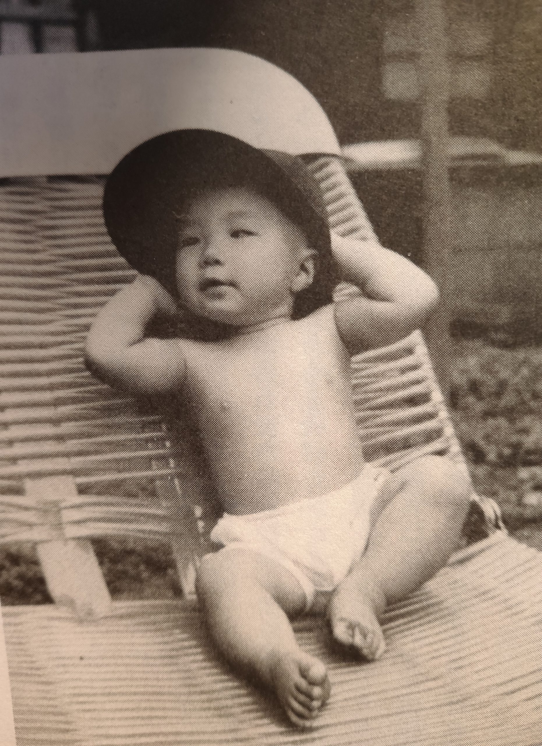 東山紀之 生い立ち 火傷